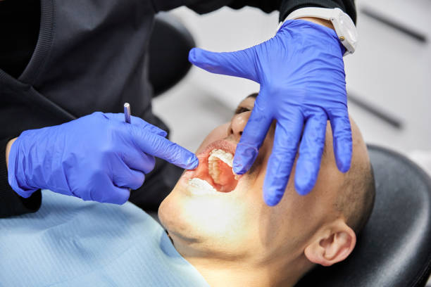 Best Emergency Wisdom Teeth Removal in Athens, PA